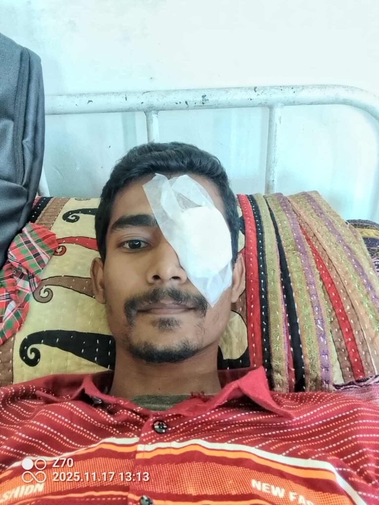 বন্ধুর কাছে ফেসওয়াশ ক্রয় করাই কল হলো শাহাজাদের